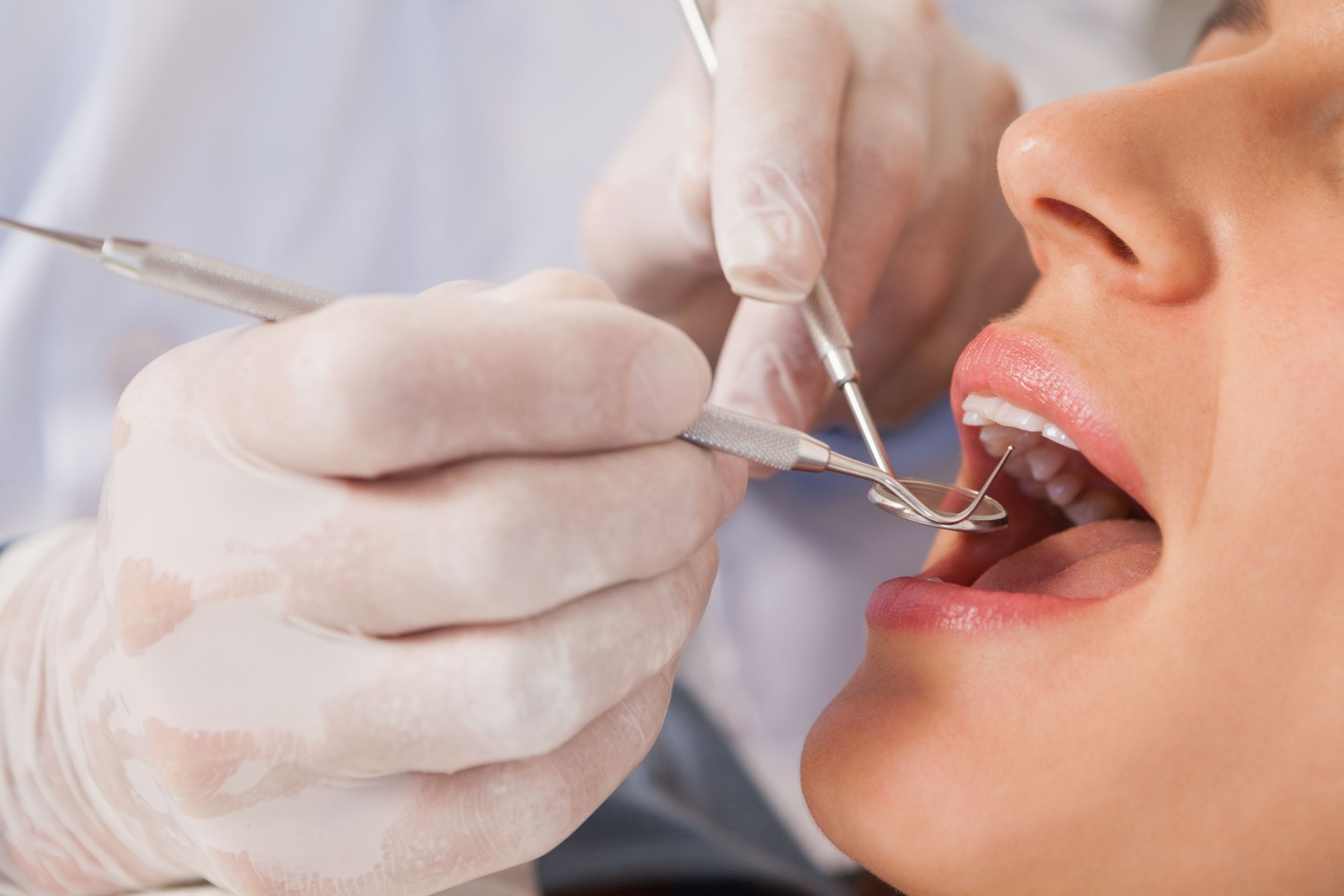 dental services