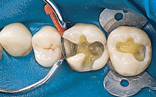 dental services