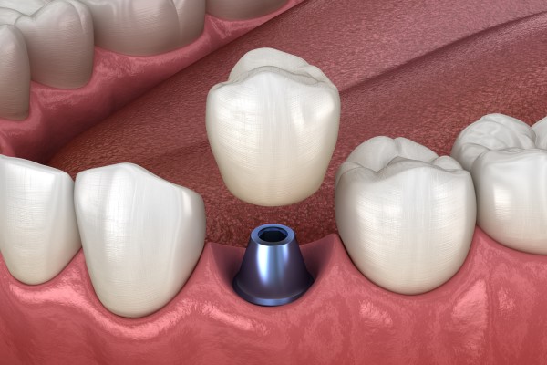 dental services