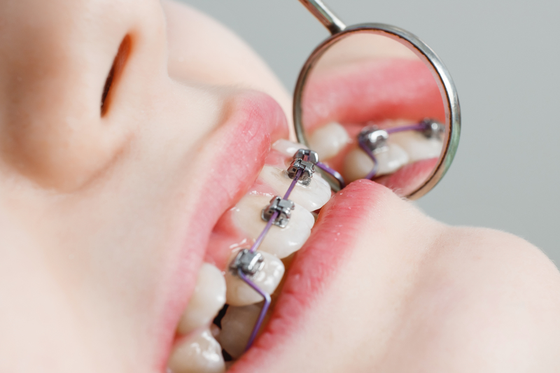 dental services
