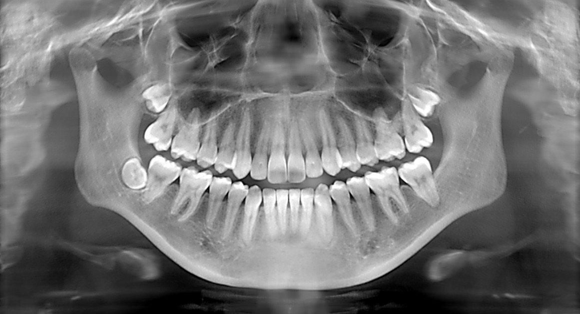 dental services