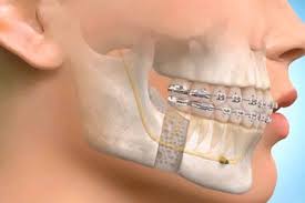 dental services