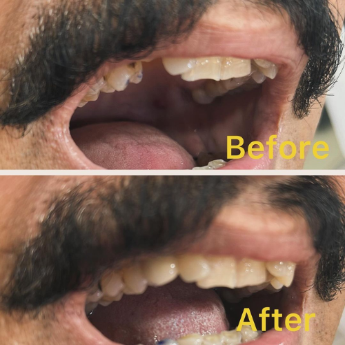 dental result