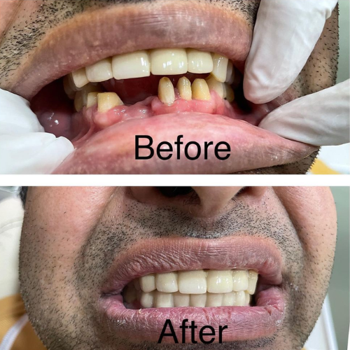 dental result