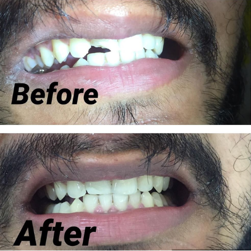 dental result