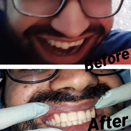 dental result