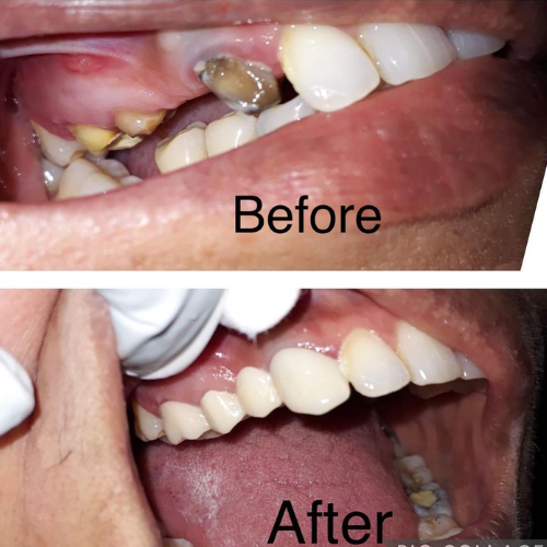 dental result