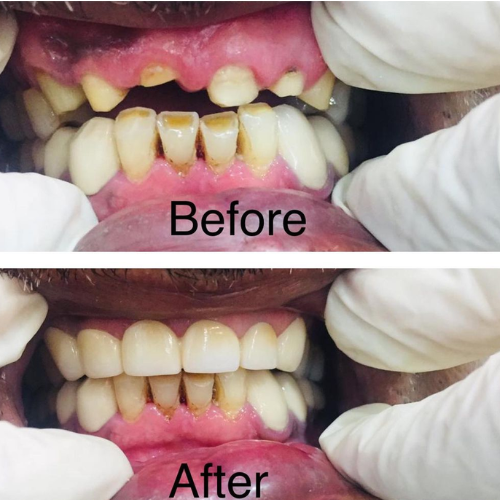 dental result