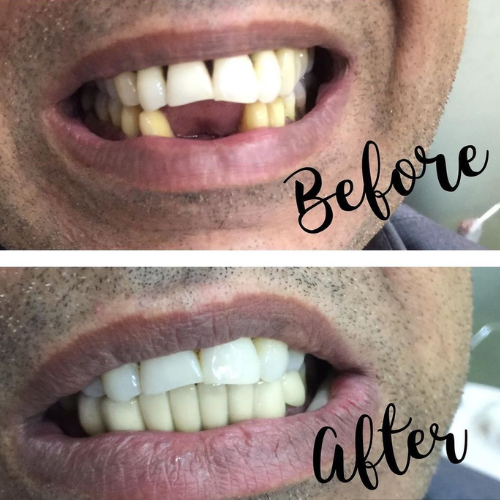 dental result