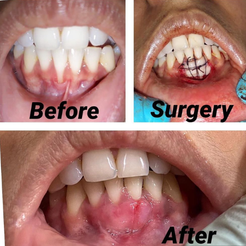 dental result