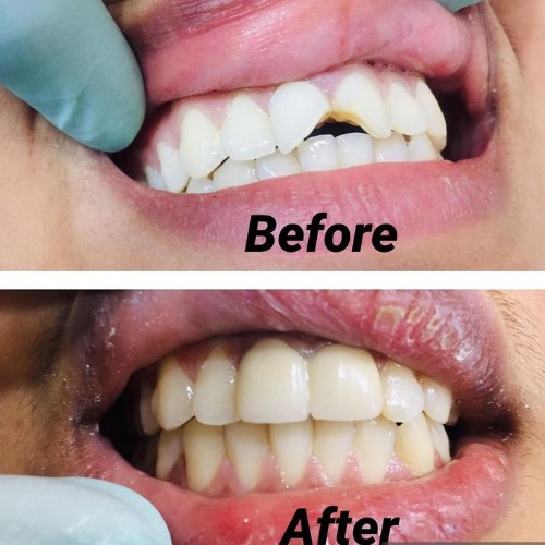 dental result