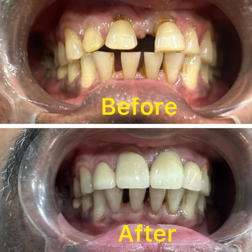 dental result