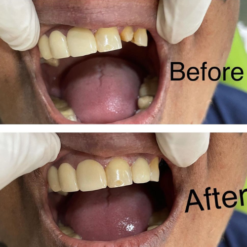 dental result