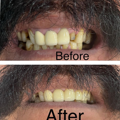 dental result