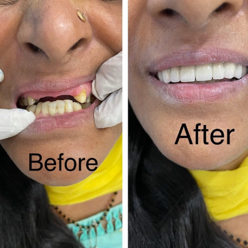 dental result