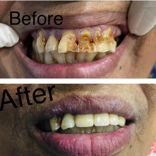 dental result