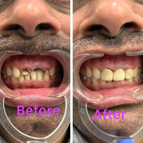 dental result