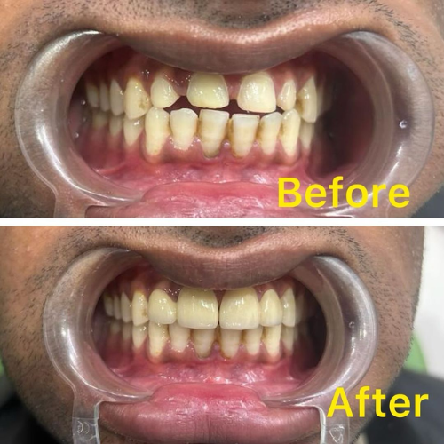 dental result