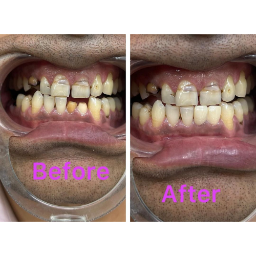 dental result