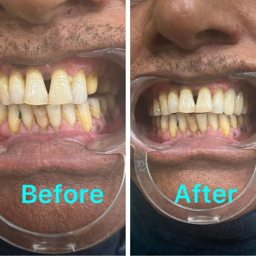 dental result