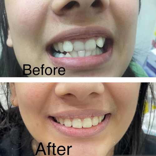 dental result