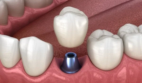3 dental services
